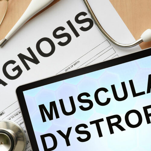 Muscular dystrophy – Warning signs and management