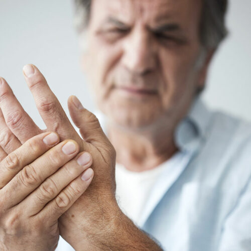 Arthritis – Types, signs and risk factors